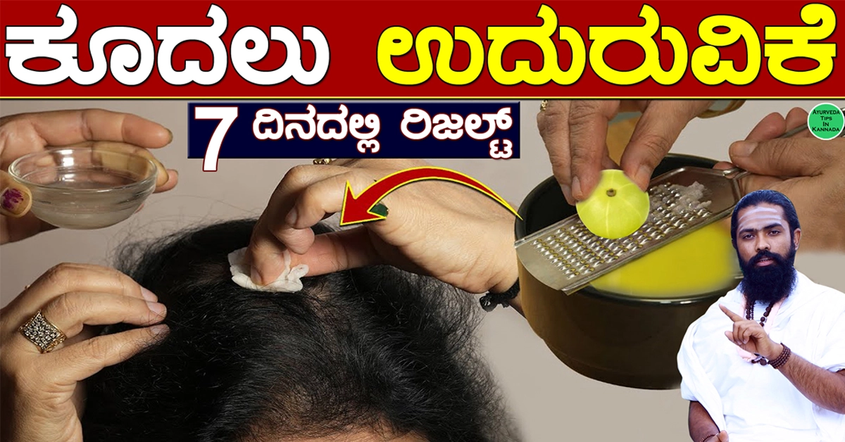 Hair Loss Kannada