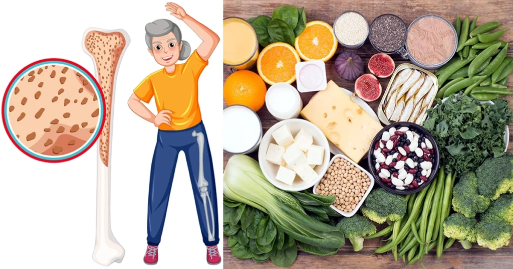 ಈ ಲಕ್ಷಣಗಳು ಇದ್ದರೆ ಕ್ಯಾಲ್ಸಿಯಂ ಕಡಿಮೆ ಆಗಿದೆ ಎಂದರ್ಥ.! - AYURVEDA TIPS IN KANNADA Calcium Rich Foods