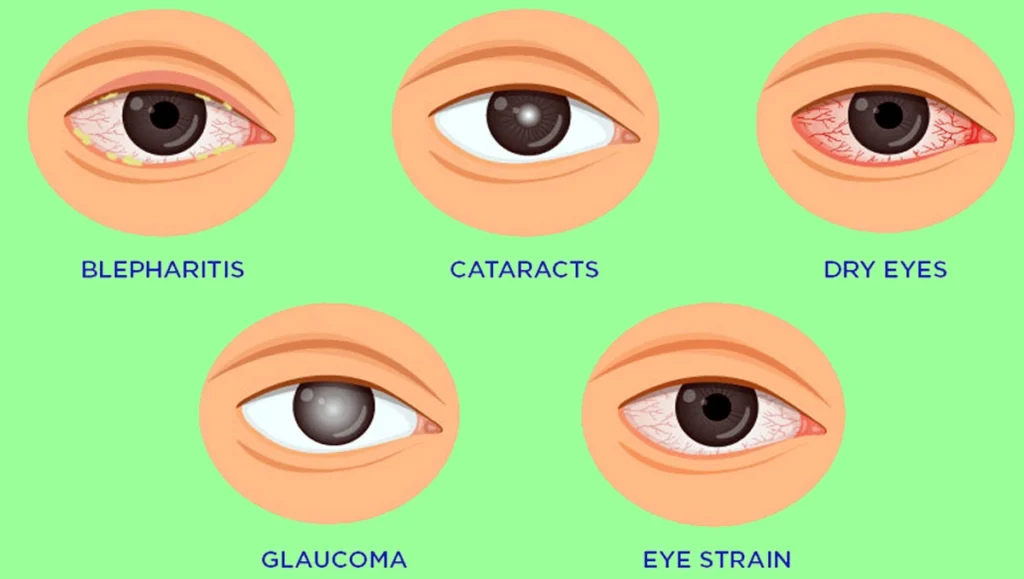 Eye Problems Kannada 