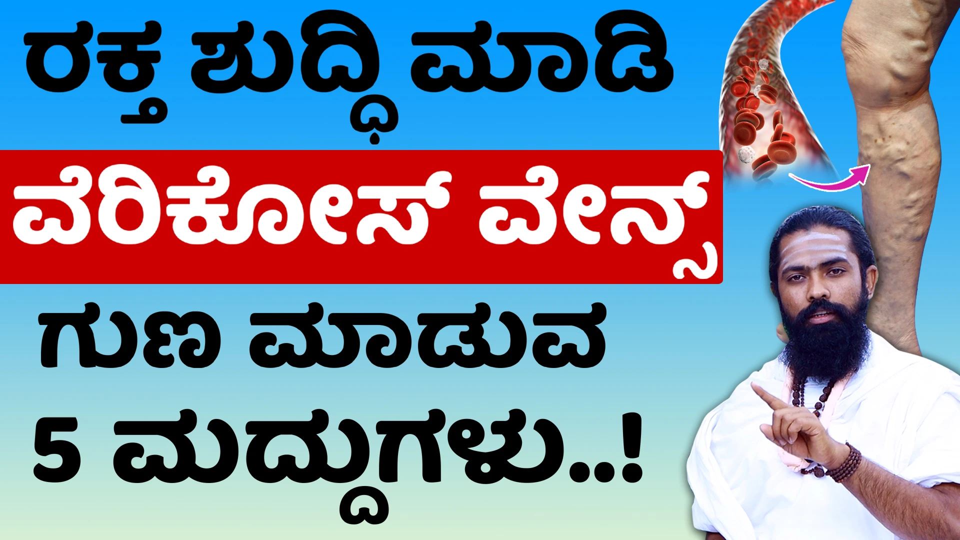 ಹೀಗೆ ಮಾಡಿದರೆ ವೆರಿಕೋಸ್‌ ವೇನ್ಸ್‌ ಪ್ರಾಬ್ಲಮ್‌ ಬರೋದಿಲ್ಲ.!